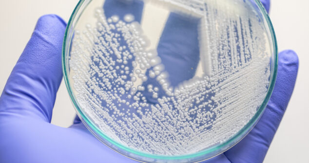 A gloved hand holding a petri dish with bacterial colonies growing on agar. The colonies appear as white, circular formations, streaked across the surface in a pattern indicative of microbiological culturing techniques. The background is blurred, emphasizing the petri dish and the microbial growth.