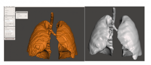 functional models from anatomical scans