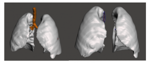 functional models from anatomical scans