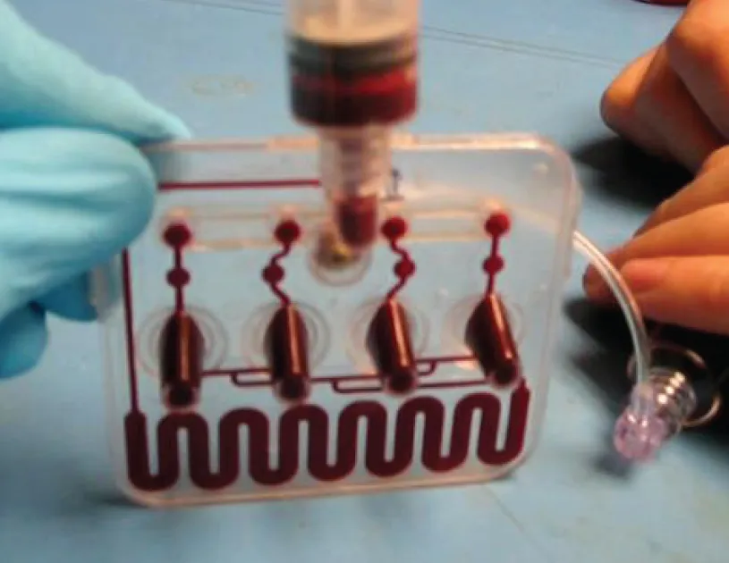 HemoSonics disposable cartridge being filled with blood during testing