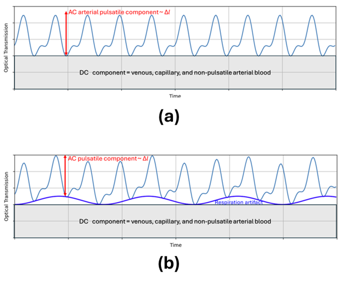 Two line plots showing optical transmission over time for pulse oximetry signals. Top Plot: Shows a regular pulsatile waveform representing the arterial blood signal. The AC component (marked in red) is labeled as the arterial pulsatile component (ΔI), superimposed on a DC component (shaded gray area) representing venous, capillary, and non-pulsatile arterial blood. Bottom Plot: Similar to the top plot but includes a slower, low-frequency undulating signal overlaid in purple, labeled respiration artifact. This waveform modulates the amplitude of the pulsatile signal, showing how breathing can influence the optical signal. Both plots illustrate the decomposition of the optical transmission signal into AC and DC components, emphasizing the pulsatile nature of arterial blood flow and the impact of respiration.